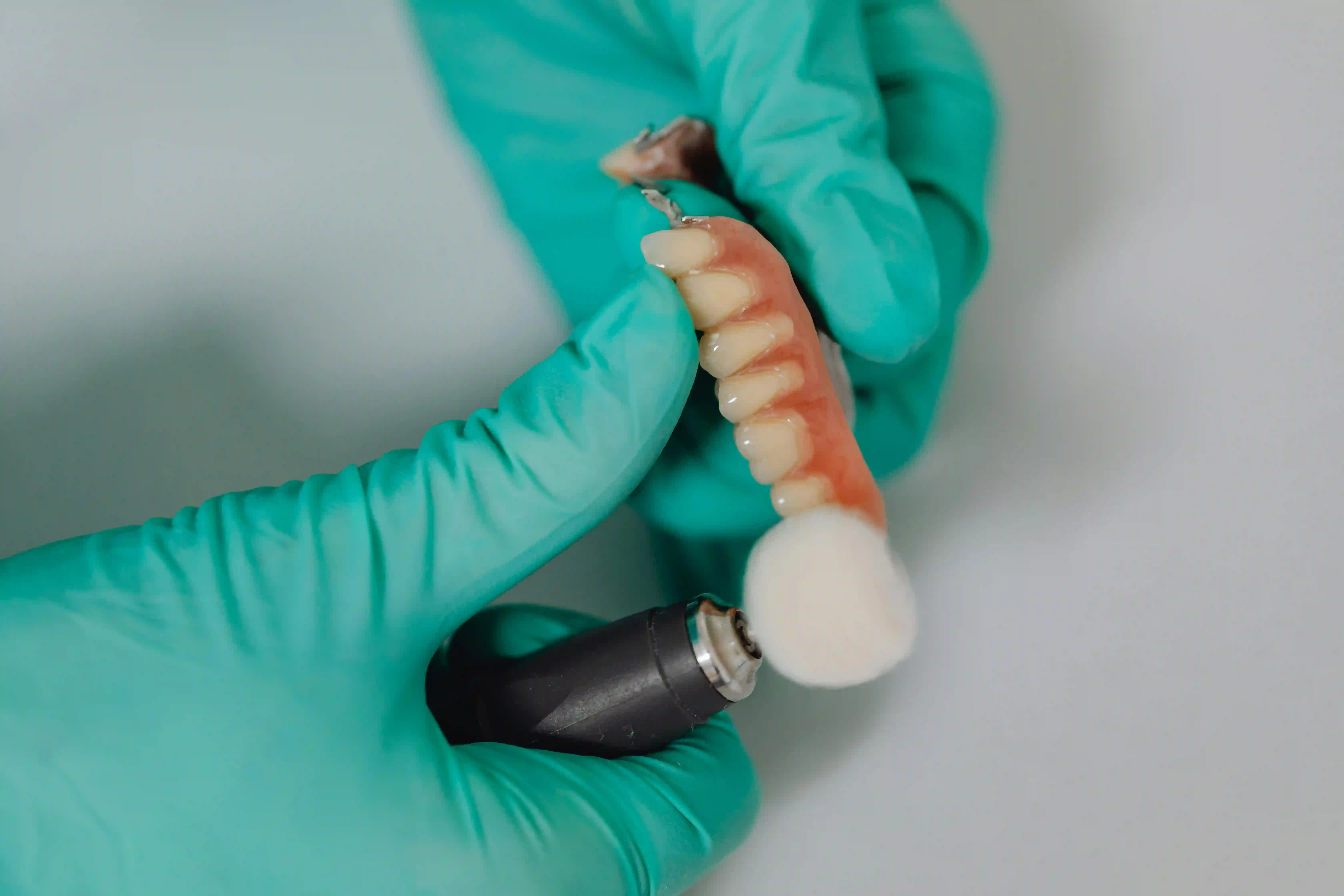 Implantes